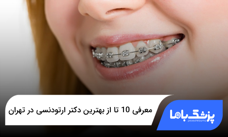 بهترین دکتر ارتودنسی در تهران