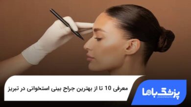 بهترین جراح بینی استخوانی در تبریز