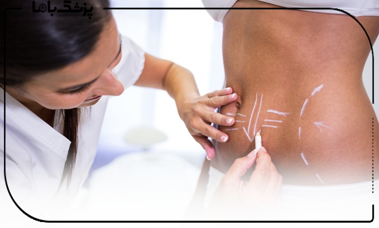 چگونه بهترین دکتر پیکرتراشی در ساری را انتخاب کنیم؟