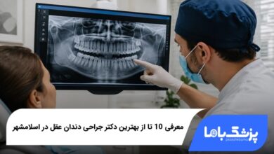 بهترین دکتر جراحی دندان عقل در اسلامشهر