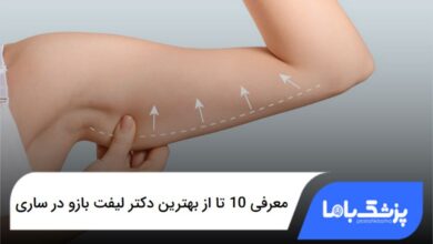 بهترین دکتر لیفت بازو در ساری