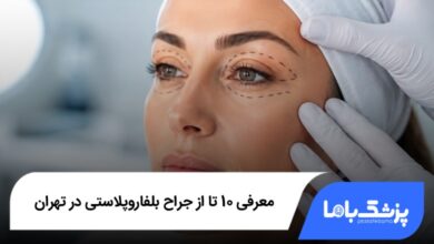 بهترین جراح بلفاروپلاستی در تهران