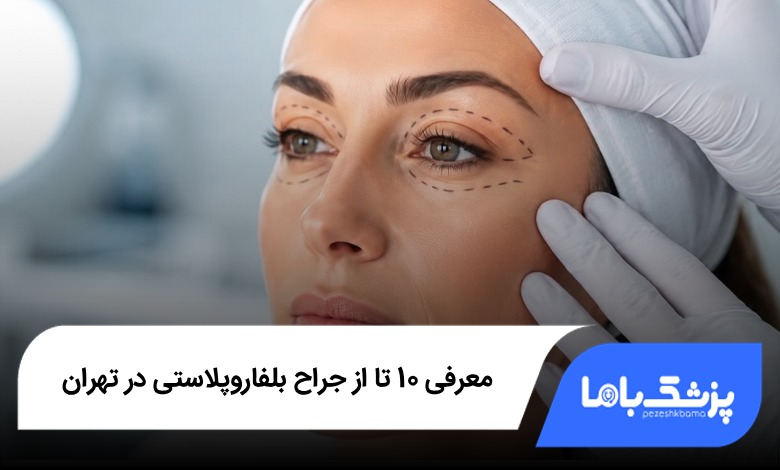 بهترین جراح بلفاروپلاستی در تهران