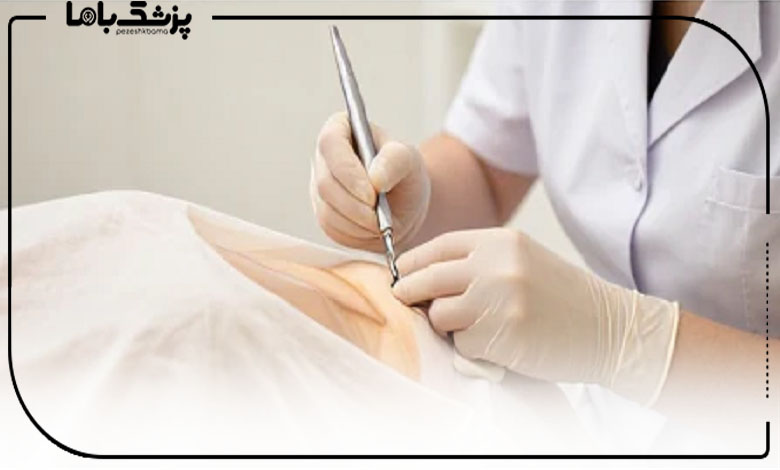 چطور دکتر معتبر برای فیلر بادی پیدا کنیم؟