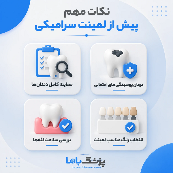 نکات مهم پیش از لمینت سرامیکی