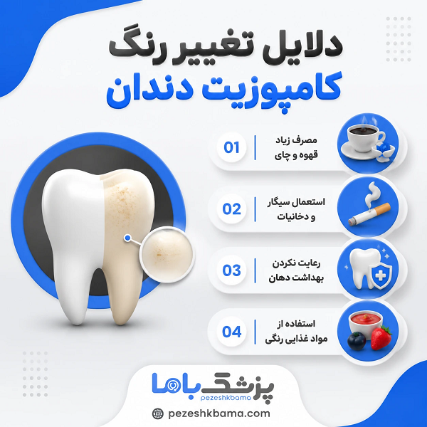 دلایل تغییر رنگ کامپوزیت دندان