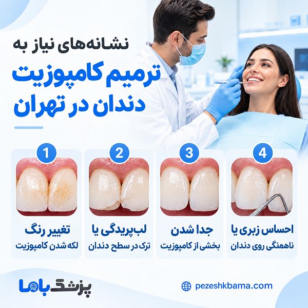 چه زمانی باید به دکتر کامپوزیت در تهران مراجعه کنیم؟