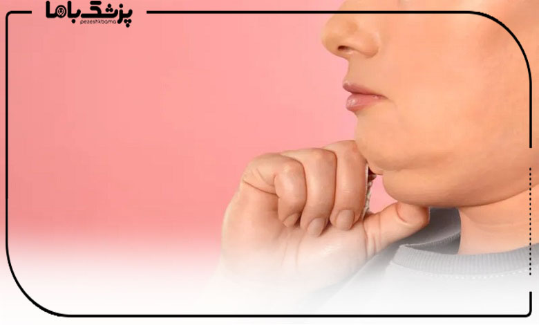 کاندید مناسب ساکشن غبغب چه کسانی هستند؟