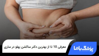 بهترین دکتر ساکشن پهلو در ساری