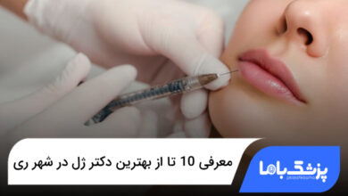 بهترین دکتر ژل در شهر ری