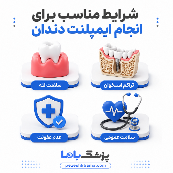 شرایط مناسب برای انجام ایمپلنت دندان