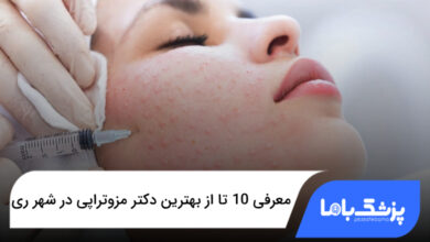 بهترین دکتر مزوتراپی در شهر ری