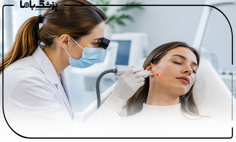 فاکتورهای مهم در انتخاب مرکز لیزر خالبرداری