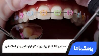 بهترین دکتر ارتودنسی در اسلامشهر