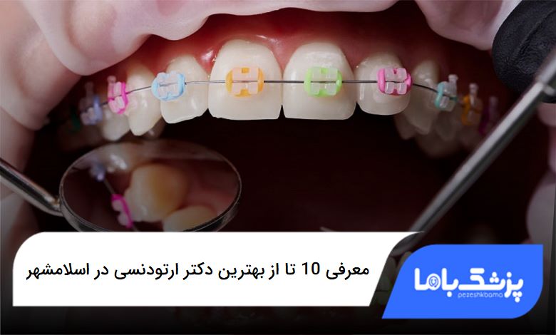 بهترین دکتر ارتودنسی در اسلامشهر