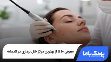 بهترین مرکز خال برداری در اندیشه