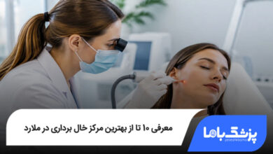 بهترین مرکز خال برداری در ملارد