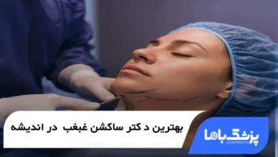 بهترین دکتر ساکشن غبغب در اندیشه