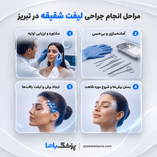 روشهای جراحی لیفت شقیقه