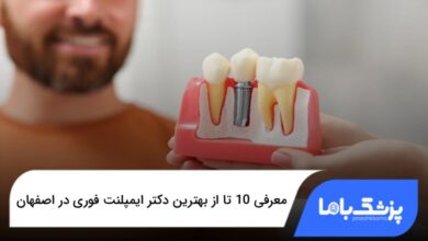 بهترین دکتر ایمپلنت فوری در اصفهان