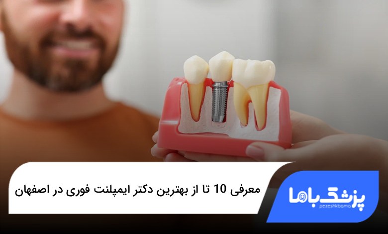 بهترین دکتر ایمپلنت فوری در اصفهان