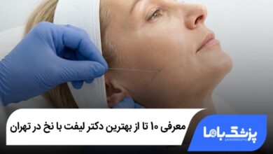 بهترین دکتر لیفت با نخ در تهران