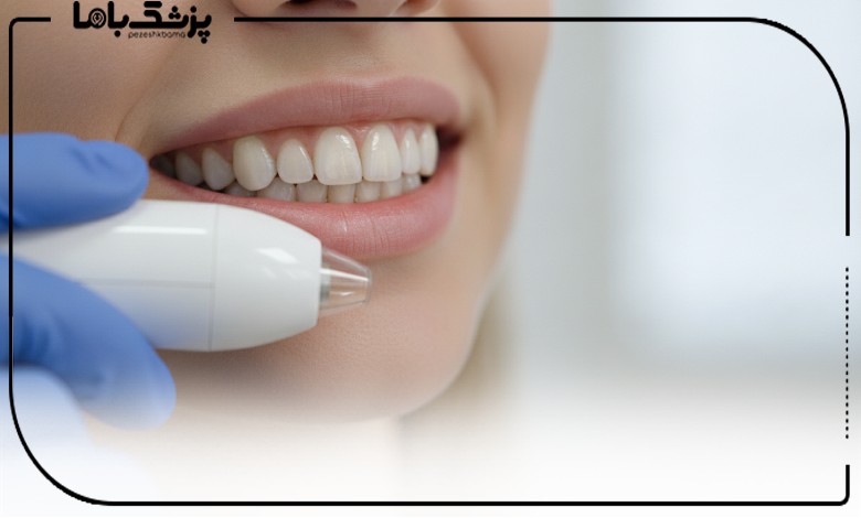 قالبگیری مدرن در بهترین کلینیک دندانپزشکی دیجیتال در تهران