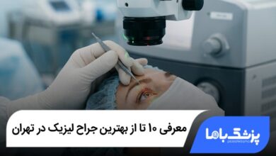 بهترین جراح لیزیک در تهران