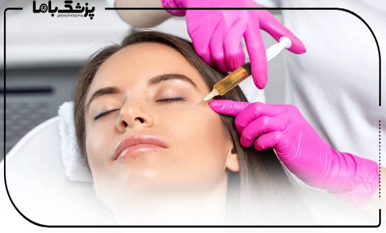 تزریق جوانساز توسط دکتر پی آر پی تبریز
