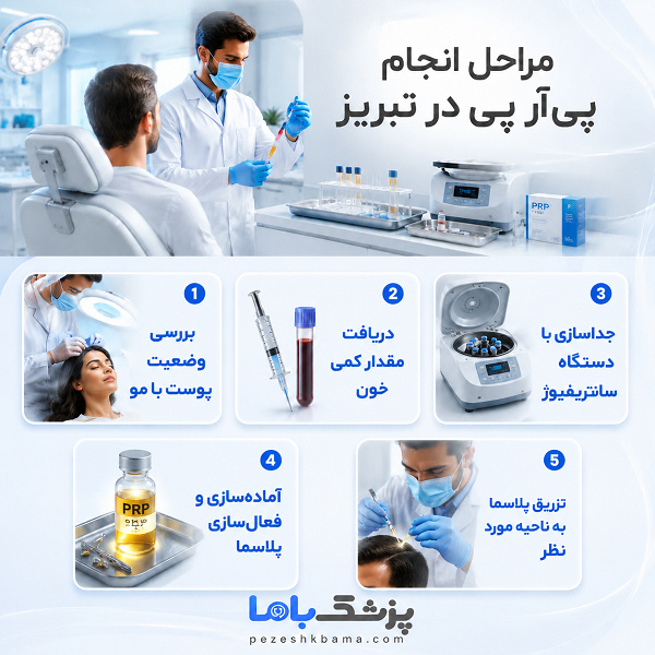 مراحل انجام پی آر پی در تبریز