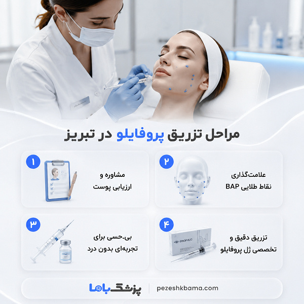 مراحل تزریق پروفایلو در تبریز