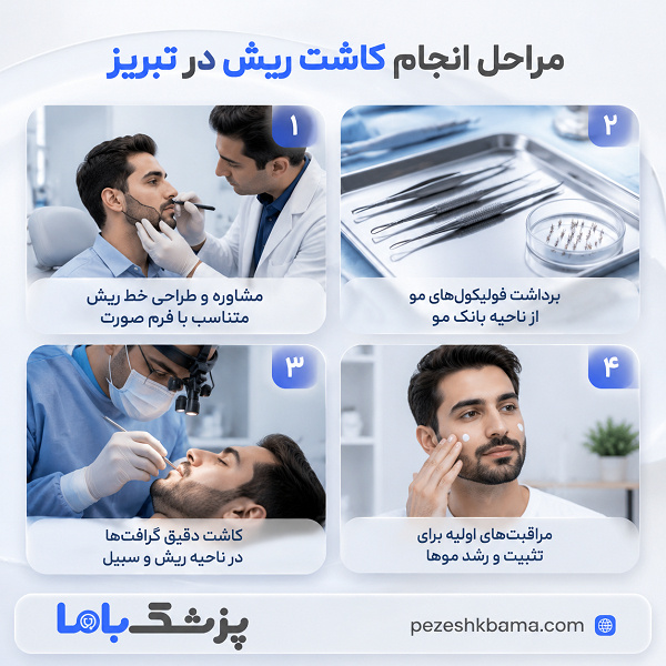 مراحل انجام کاشت ریش در تبریز