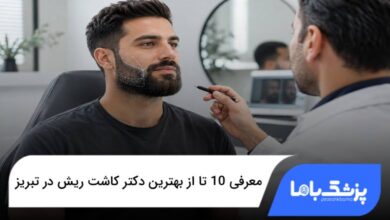 بهترین دکتر کاشت ریش در تبریز