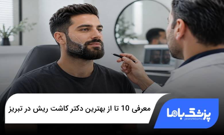بهترین دکتر کاشت ریش در تبریز