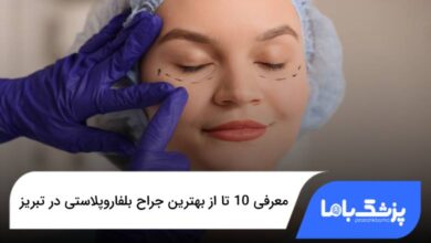 بهترین جراح بلفاروپلاستی در تبریز