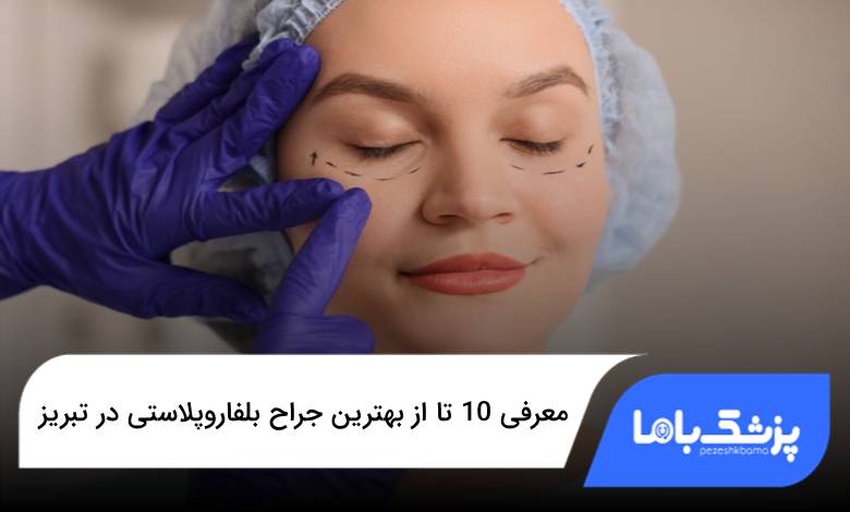 بهترین جراح بلفاروپلاستی در تبریز