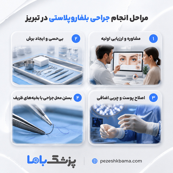 بلفاروپلاستی بهتر است یا لیفت شقیقه؟