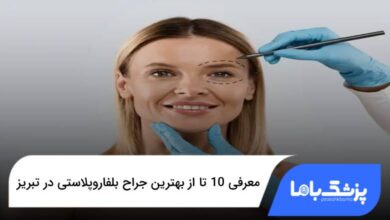 بهترین جراح بلفاروپلاستی در تبریز