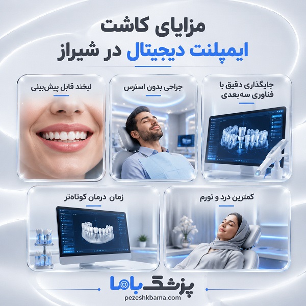 مزایای کاشت ایمپلنت دیجیتال در شیراز