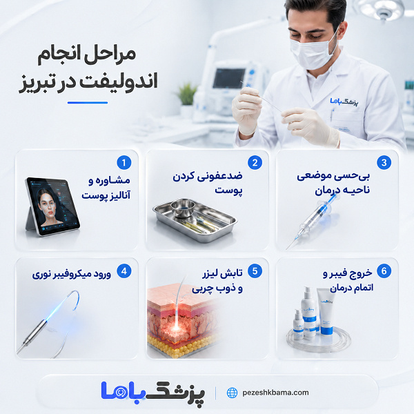 مراحل انجام اندولیفت در تبریز
