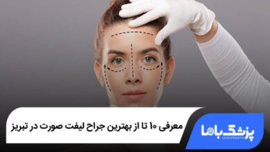 بهترین جراح لیفت صورت در تبریز