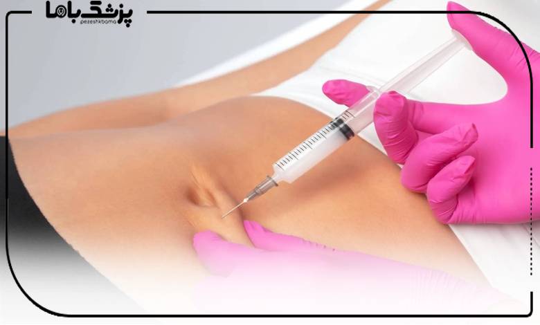انجام تزریق چربی توسط پزشک متخصص در تبریز
