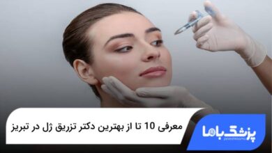 بهترین دکتر تزریق ژل در تبریز