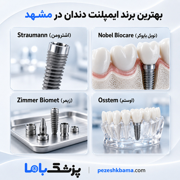 تفاوت ایمپلنت و بریج دندان چیست؟