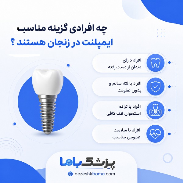 چه افرادی گزینه مناسب ایمپلنت در زنجان هستند؟