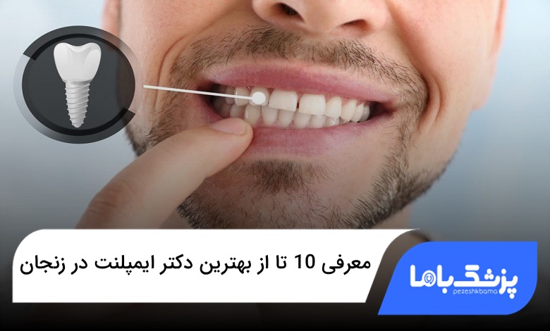 بهترین دکتر ایمپلنت در زنجان