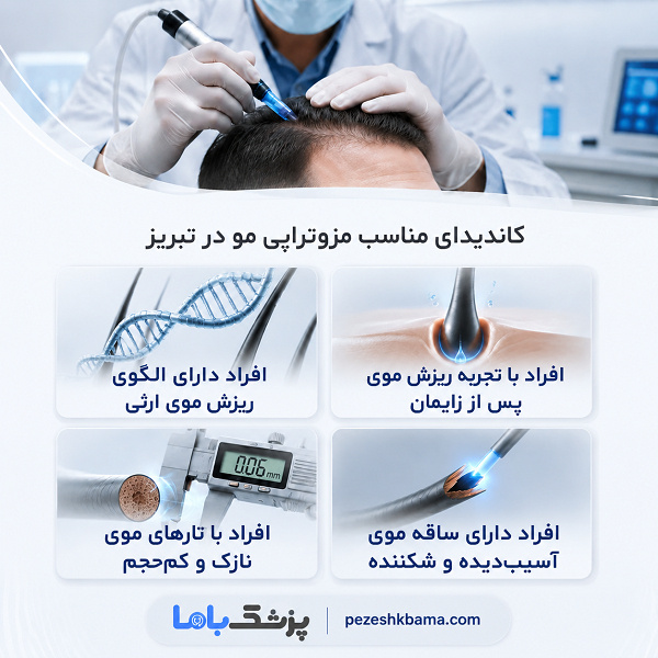 کاندیدای مناسب مزوتراپی مو در تبریز