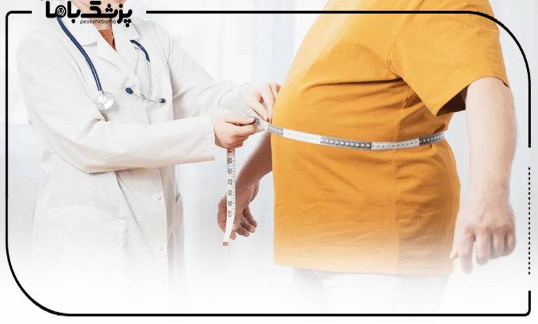چرا انتخاب بهترین جراح چاقی در موفقیت عمل اهمیت دارد؟