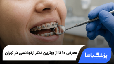 بهترین دکتر ارتودنسی در تهران