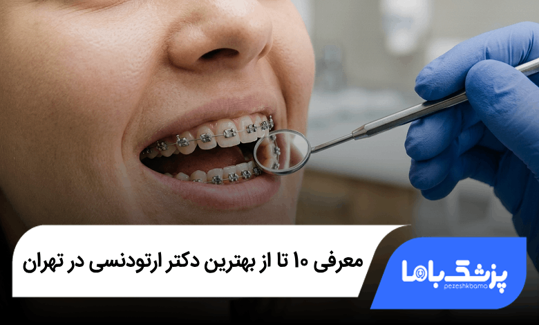 بهترین دکتر ارتودنسی در تهران